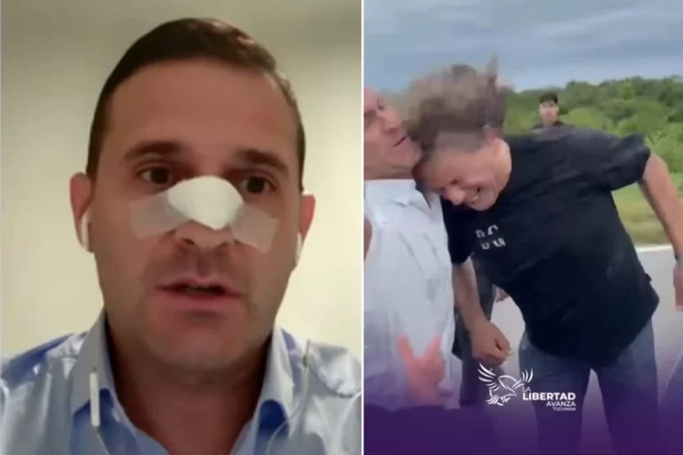 Pelli, tras la agresión: “Me operaron y podrían volver a intervenirme”,